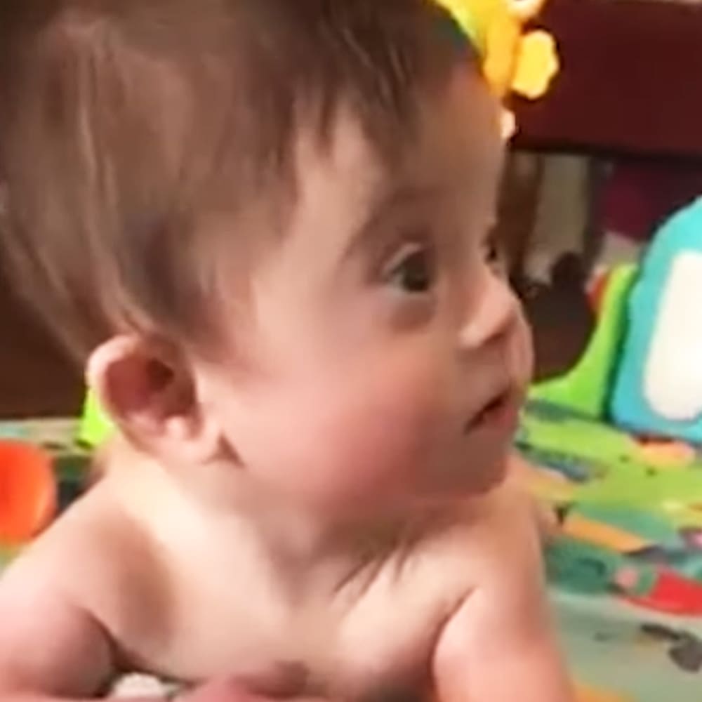 Baby with down syndrome